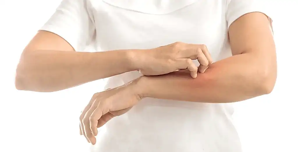 Sedef Hastalığı Tedavisi 1 Sedef Hastalığı Tedavisi