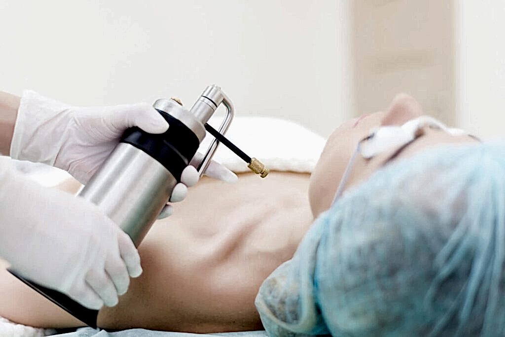 Kriyoterapi 1 Kriyoterapi